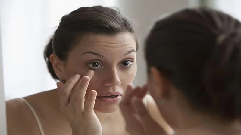 علاجات منزلية للتخلص من الإنتفاخ تحت العين