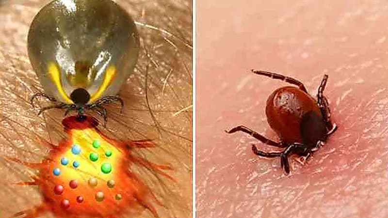 اليابان تسجل أول حالة وفاة في العالم بفيروس أوز