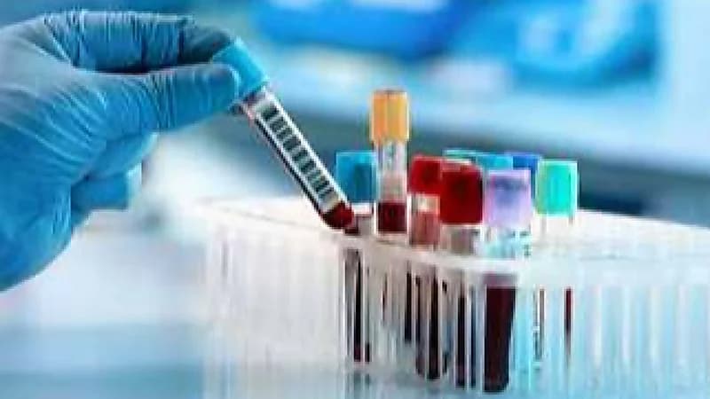 أخصائية مختبر : الفحص المخبري للأمراض الوراثية يقي الزوجين من أن يأتيهم طفل مصاب .. فيديو