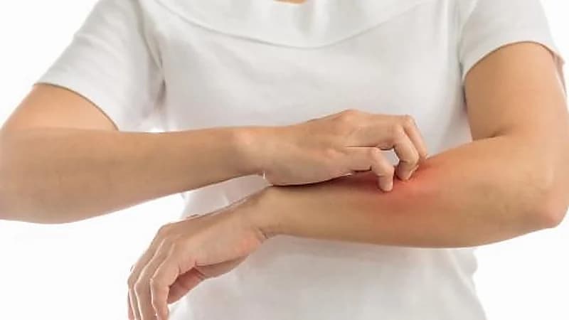 الشهري يوضح سبب الحكة الجلدية بعد ممارسة التمارين الرياضية .. فيديو