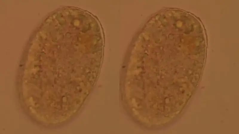 ‎أطباء يكتشفون ديدانًا مماصةً للدماء في أمعاء امرأة