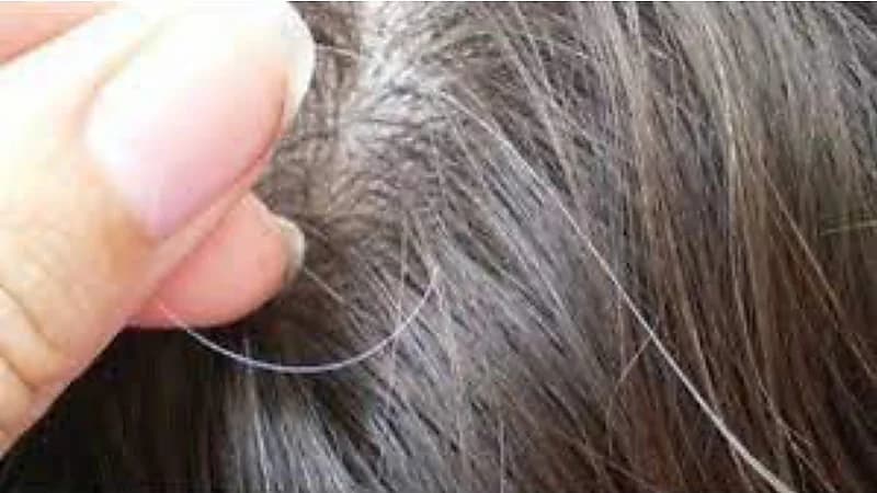 استشاري يوضح الفرق بين الشيب الطبيعي والمبكر.. فيديو