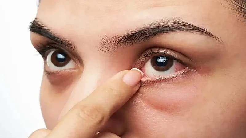 علامة في العين تشير لقرب الإصابة بمرض الفصام