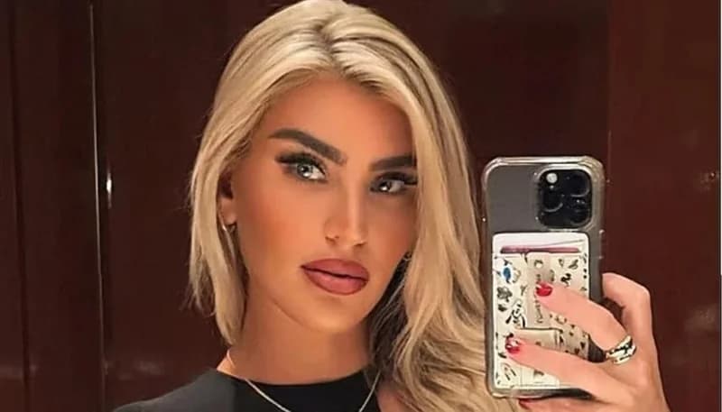 مرشحة لملكة جمال الكون تتعرض لاعتداء عنيف على يد صديقها