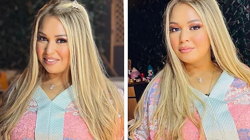 ويزو ترد على شائعات التكميم وتكشف سر خسارة وزنها .. صور