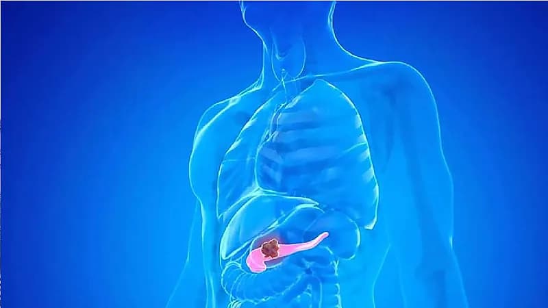 6 أمراض أحد أعراضها ألم الظهر من الجهة اليسرى .. فيديو