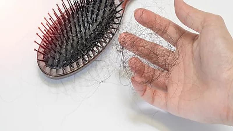 سبب تساقط الشعر في الخريف