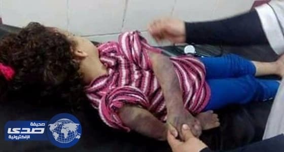 شاهد طفلة مصرية عذبها والدها حتى الموت