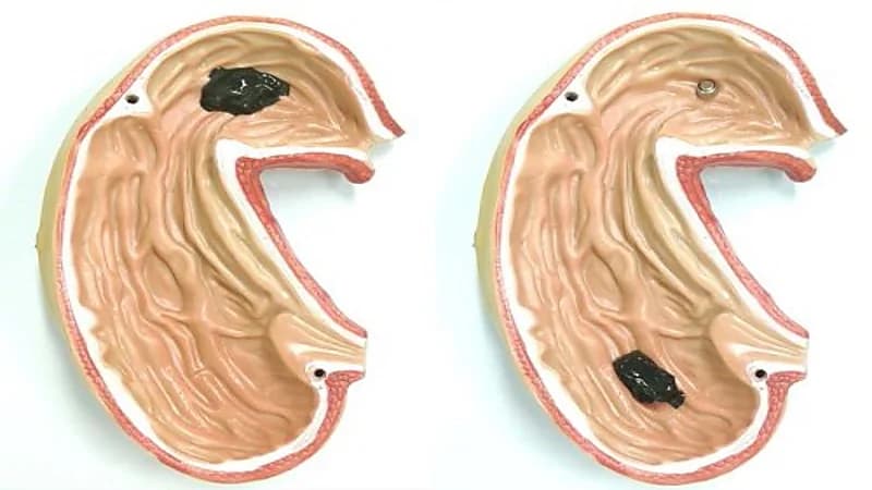 تطوير روبوت يخترق الجسم البشري