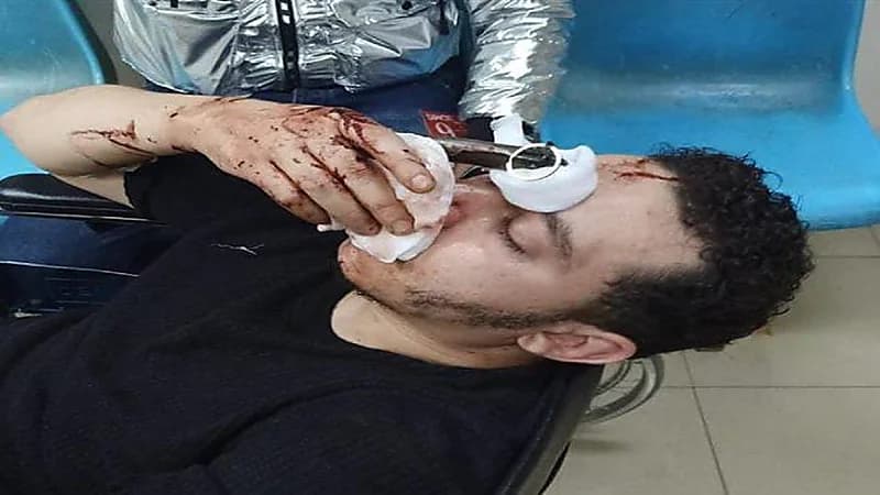 أطفال يغرسون "سكين" برأس جارهم