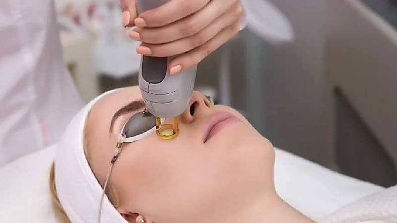 أخطاء يجب تجنبها بعد جلسات الليزر .. فيديو