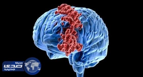 دراسة أمريكية: فيروس " زيكا " يساعد في علاج السرطان