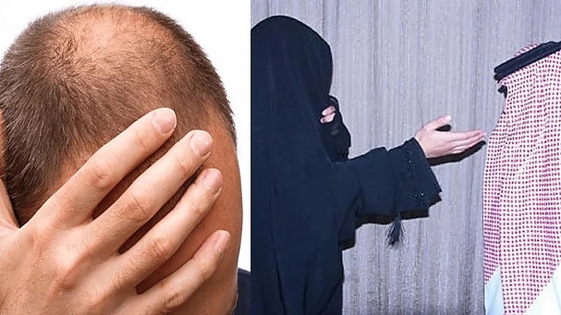 مواطنة تطلب الطلاق بعد أول يوم زواج: "اكتشفت إنه أصلع"