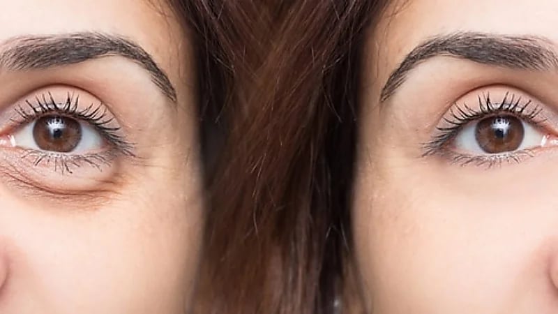 علي الحداد : 4 أسباب لرفرفة العين وهذه طرق الوقاية .. فيديو