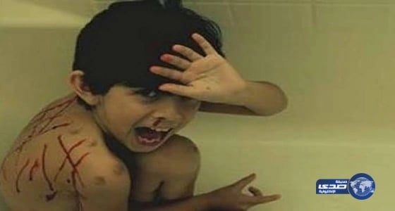 وفاة طفلة غرقاً في بحيرة بحائل