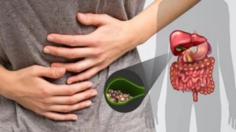 هل يمكن علاج حصوات المرارة بغير الجراحة؟.. طبيب باطنية يُجيب