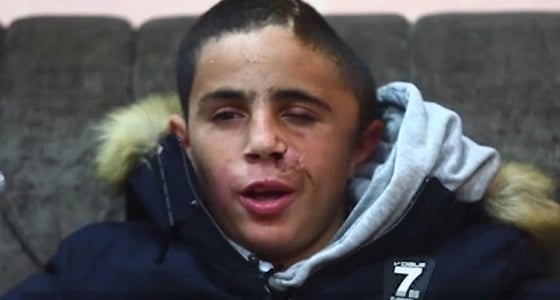 تفاصيل صفعة هبة عهد التميمي للجندي الإسرائيلي