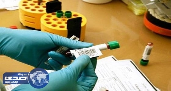 إلزام 10 جنسيات بفحص " الإيدز " عند تجديد الإقامة