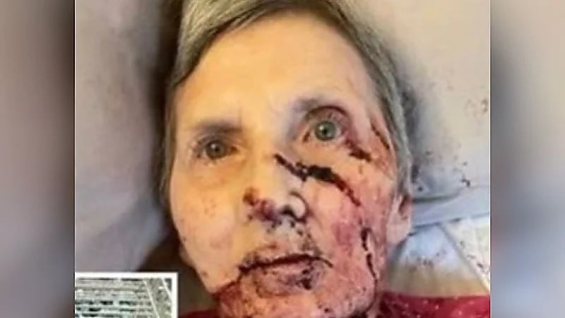 فأر يفترس سيدة ويتركها في حالة حرجة