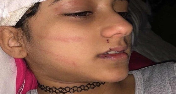 تفاصيل نجاة طفلة السوشيال ميديا من مخالب نمر