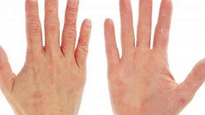 "الصحة" تقدم نصائح مهمة للحفاظ على الجلد من الجفاف في فصل الشتاء