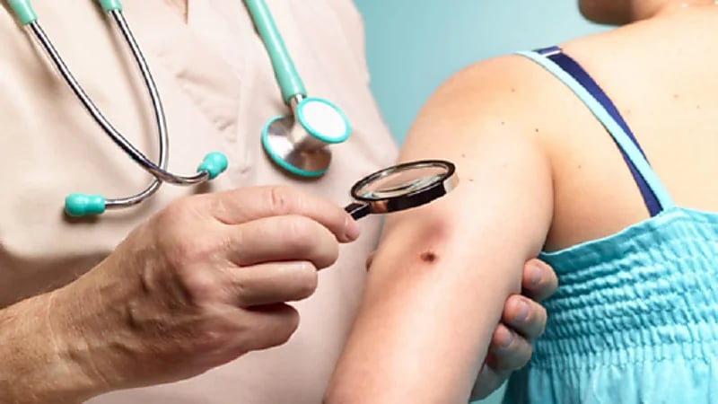 طبيب يحدد الشامات التي يجب مراقبتها