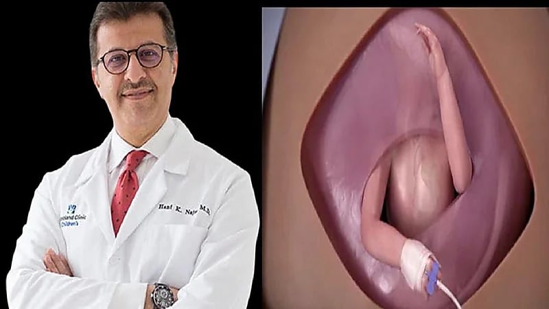 الطبيب السعودي يكشف تفاصيل العملية التي أجراها لقلب جنين في رحم أمه