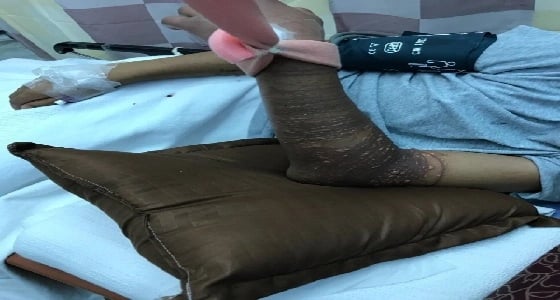 الأمير سلطان بن فهد يتدخل لعلاج شاب مصاب بلدغة حيوان بحري