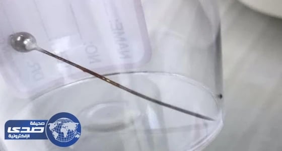 استخراج إبرة خياطة من مريء طفل بمستشفى الولادة ببريدة