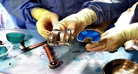 بالصور.. إجراء جراحة دقيقة لتركيب مفصل صناعي بالقصيم
