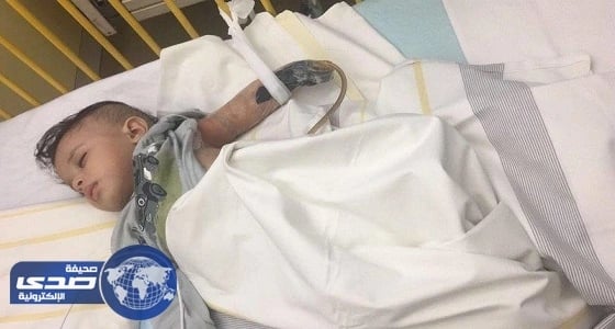 تطور جديد في جراحة الطفل " جسار " بألمانيا