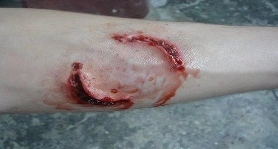 " الطاعون " ينقذ موقوف بالحقوق الأمنية من عضة فأر