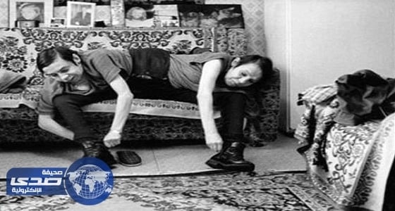 تعرف على قصة أقدم التوائم الملتصقة في العالم