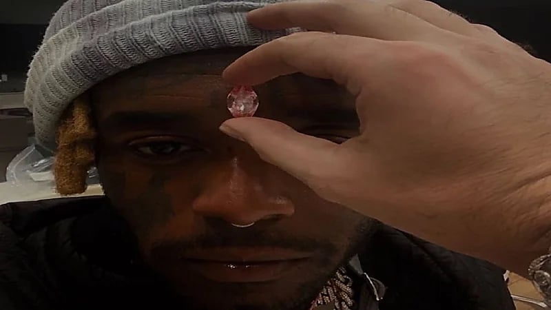 مغني يقرر زرع ماسة داخل جبهته: " وجودها في رأسي يجعلها بمكان آمن "