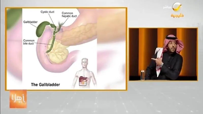 استشاري : الجراحة هي الحل الأمثل لحصوات المرارة (فيديو)
