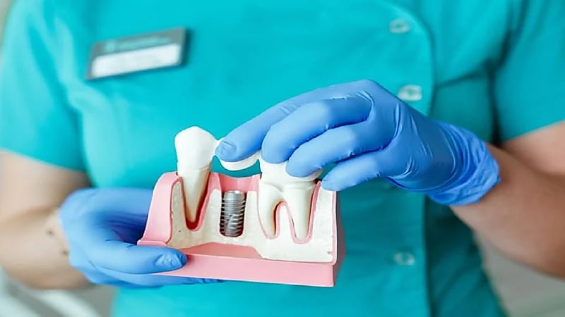 بالفيديو.. محامي: يحق للمتضرر من إعلانات عيادات زراعة الأسنان رفع دعوى