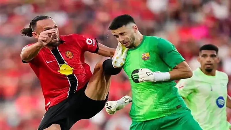 آثار صادمة نتيجة التدخل العنيف على وجه حارس برشلونة .. صورة