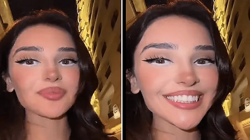 فتاة تجري عملية لتحويل أسنانها لأنياب ثعلب..فيديو