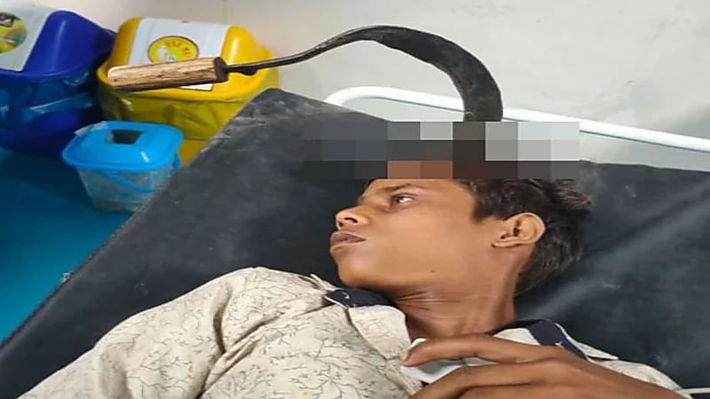 أطباء ينقذون حياة شاب بعد إزالة "محشّ" من رأسه "صور"