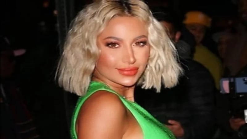 صور لمودل روز وشقيقتها في الطفولة تثير السخرية