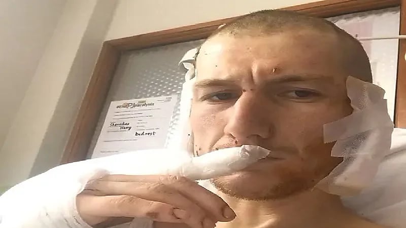 كلاب تعتدي على مغن شاب وتعضه 50 مرة ..صور