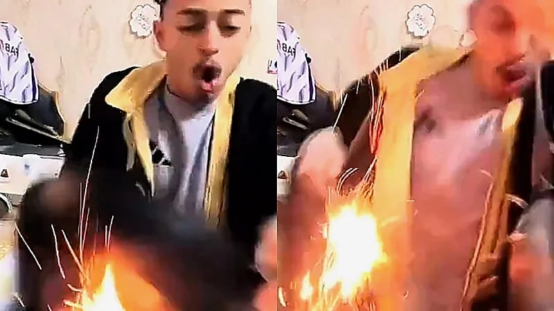 مشهد صادم لشاب ينسكب عليه الزيت المغلي أثناء البث .. فيديو