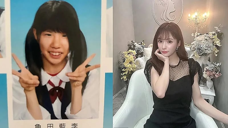 سيدة تخضع  لأكثر من 20 عملية تجميل بسبب تعرضها للتنمر