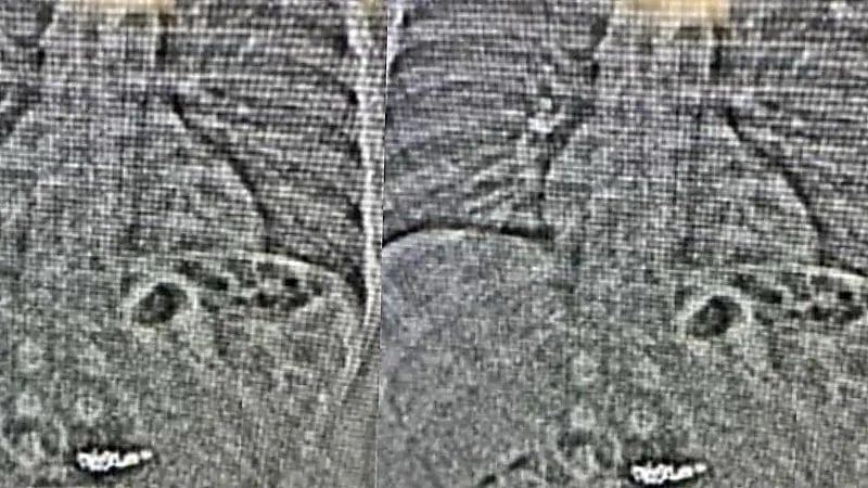 لص يبتلع أقراط ألماس بقيمة 770 ألف دولار