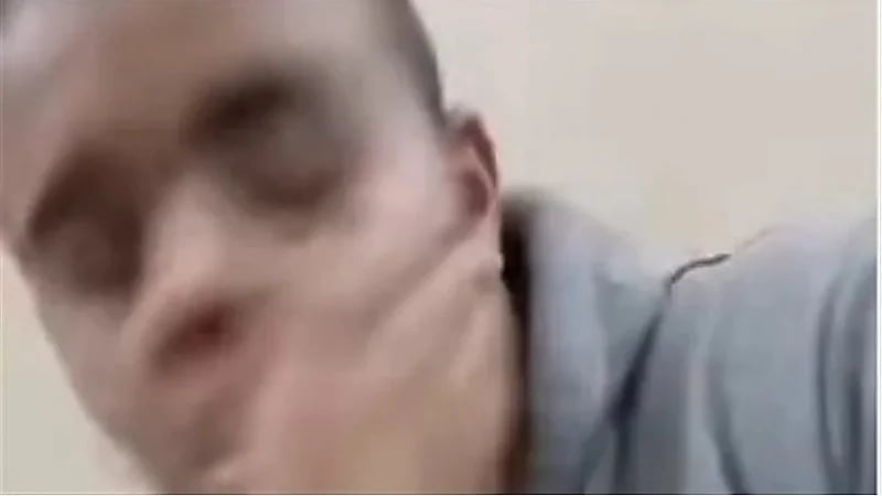 فتاة تصفع طبيب أسنان داخل عيادته