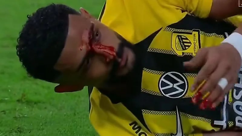 إصابة خطيرة لعبدالإله العمري .. فيديو