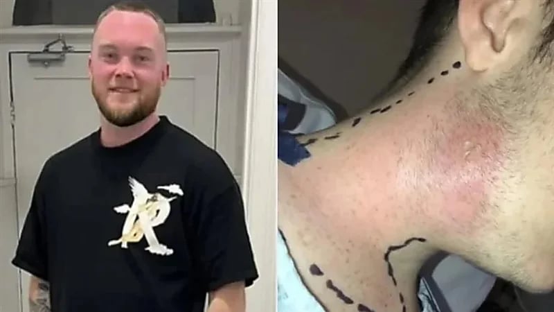 عادة يومية تتسبب في إصابة شاب بتسمم دموي قاتل