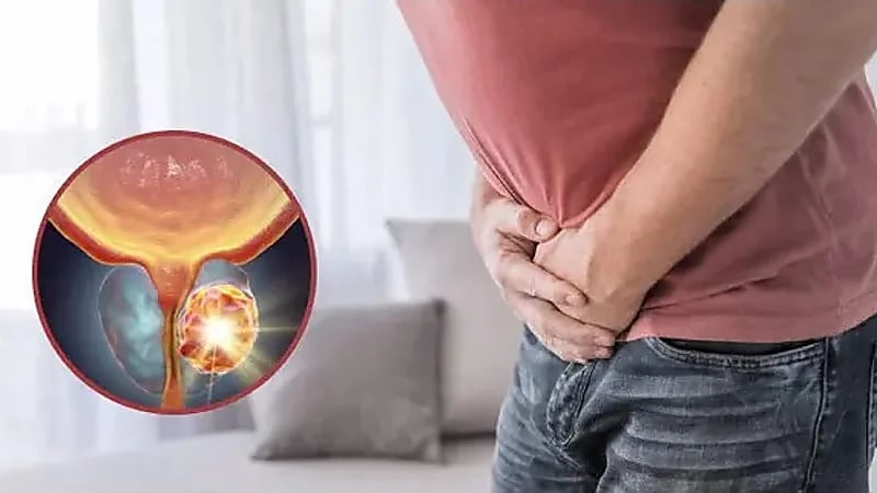 دراسة تحذر: سرطان البروستاتا منخفض الدرجة ليس آمنًا دائمًا