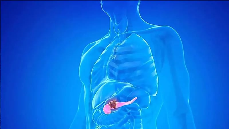 6 أمراض أحد أعراضها ألم الظهر من الجهة اليسرى .. فيديو