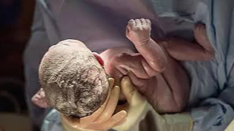 لحظة إخراج الجنين من كيس المشيمة وبداية حياته .. فيديو